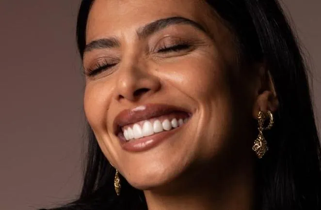Hollywood Smile en facettes Emax après