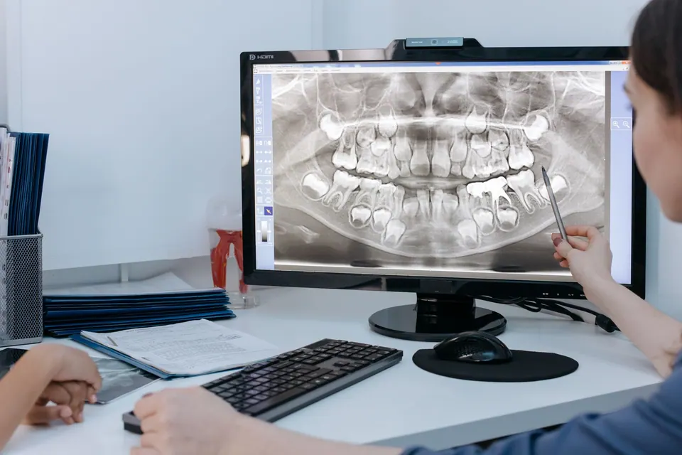 Illustration: Grey or dead tooth: internal bleaching and other solutions